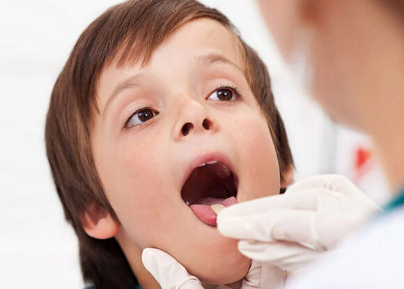 Otorrinolarongología Pediátrica